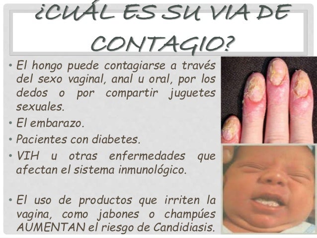 Como comienza el hongo sobre el dedo del pie