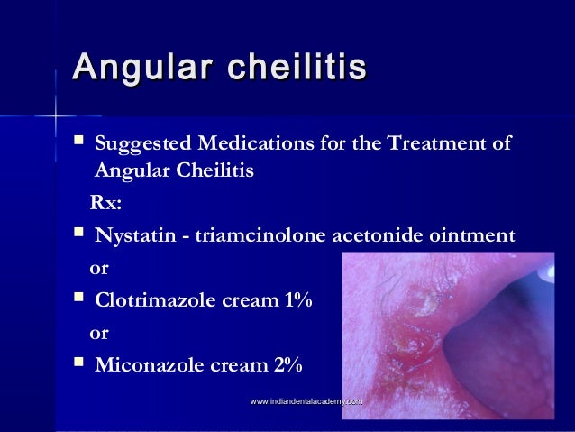 Candidiasis /cosmetic dentistry courses