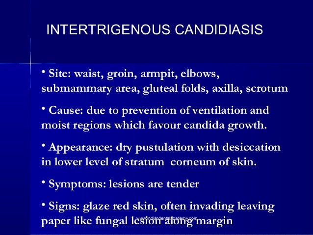 Nystatin For Candida Diaper Rash Nystatin For Candida Diaper Rash