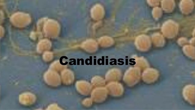 Candida persistente cause