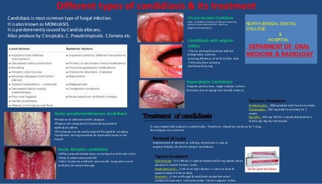 Types Of Oral Candidiasis