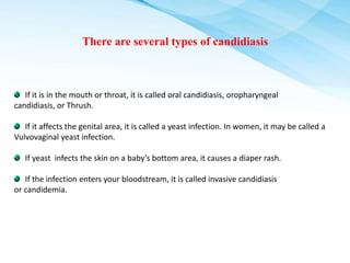 Current Developments in Prevention and Treatment of Candidiasis | PPTX