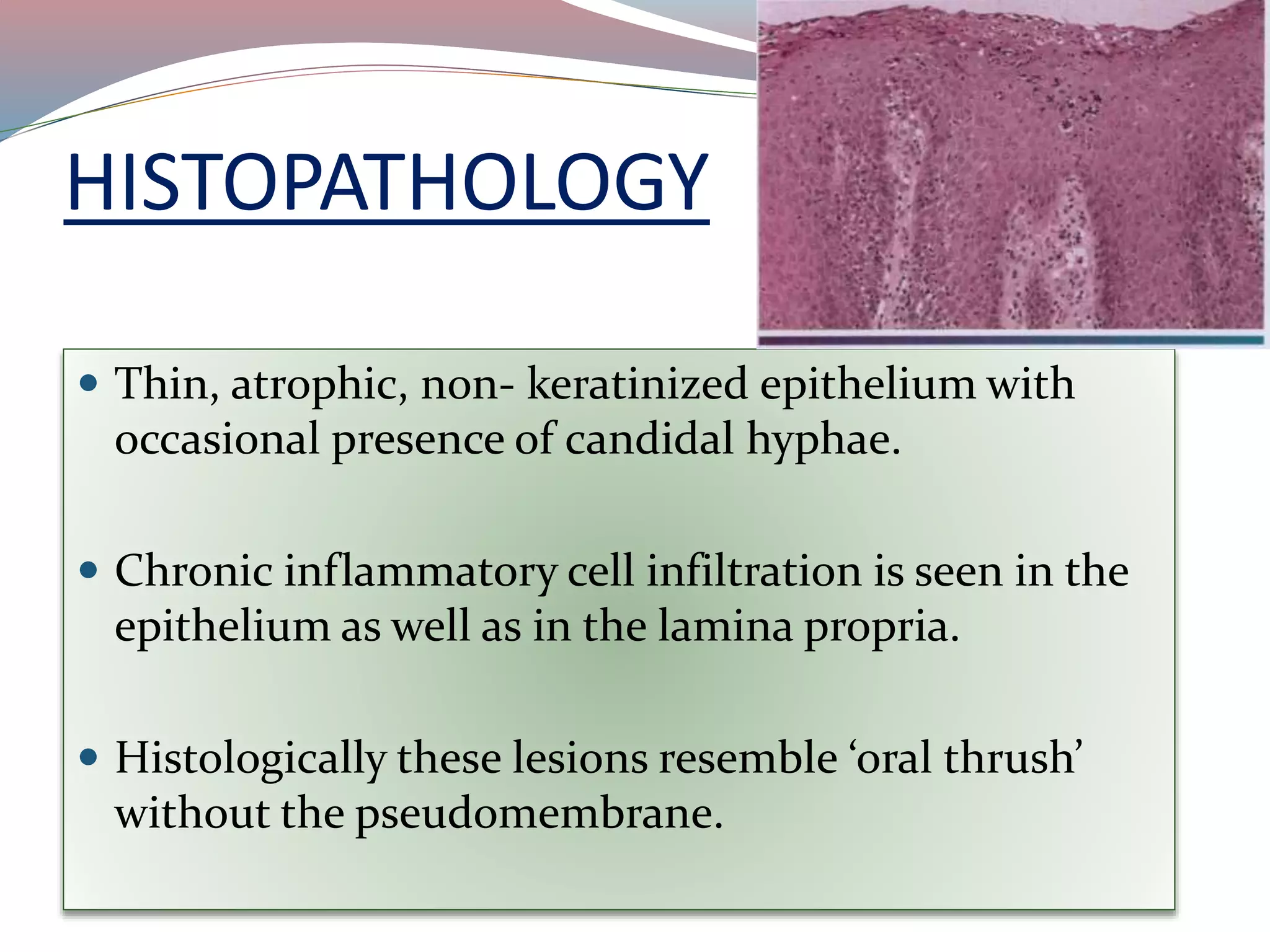 HISTOPATHOLOGY
 Thin, atrophic, non- keratinized epithelium with
occasional presence of candidal hyphae.
 Chronic inflammatory cell infiltration is seen in the
epithelium as well as in the lamina propria.
 Histologically these lesions resemble ‘oral thrush’
without the pseudomembrane.
 