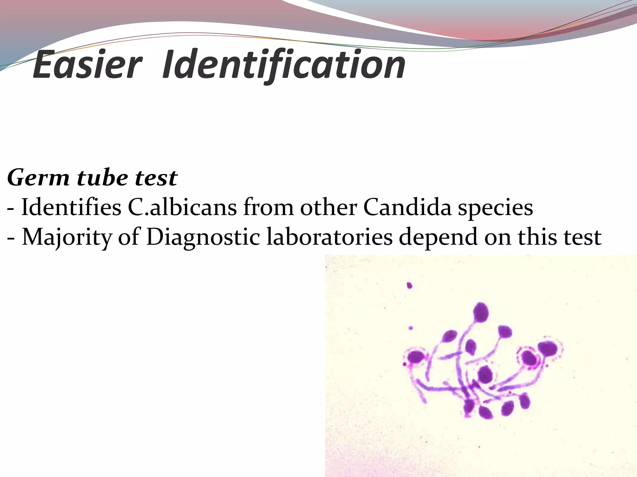 Easier Identification
Germ tube test
- Identifies C.albicans from other Candida species
- Majority of Diagnostic laboratories depend on this test
 
