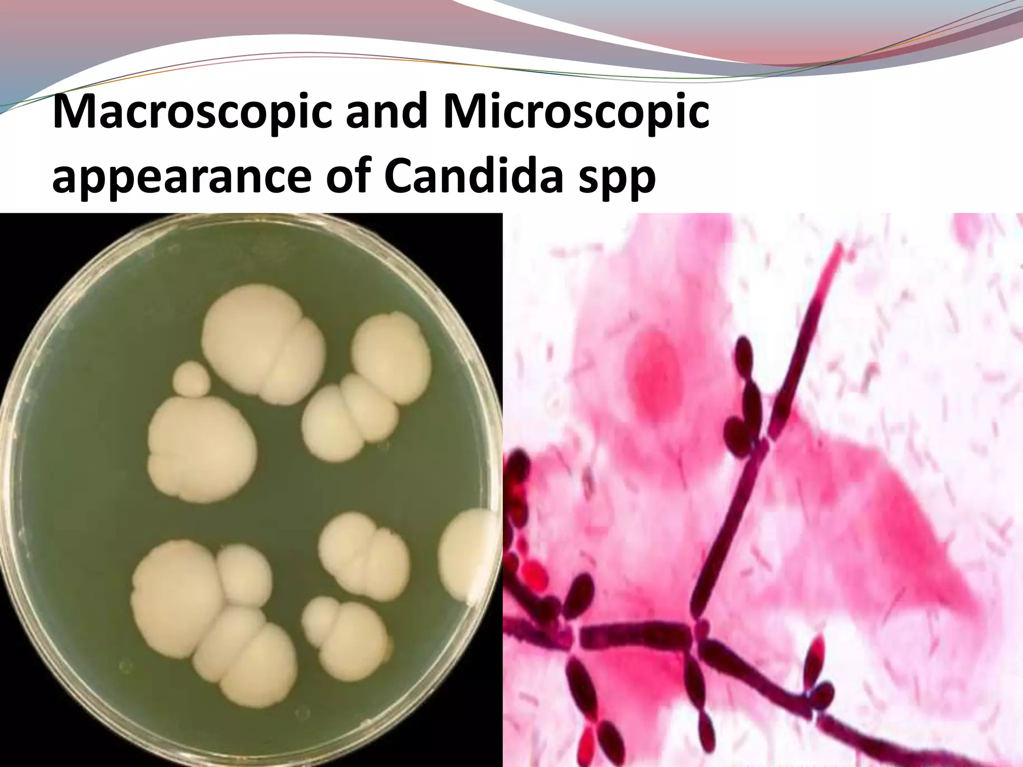 Macroscopic and Microscopic
appearance of Candida spp
 