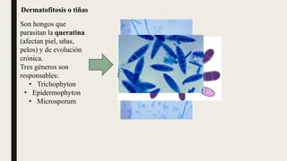 Candidiasis ppt