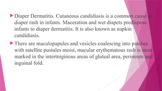CANDIDIASIS-DIFFERENT SPECIES OF CANDIDA AND ITS INFECTION | PPTX