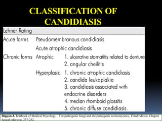 CLASSIFICATION OF
CANDIDIASIS
Rippon J. Textbook of Medical Mycology – The pathogenic fungi and the pathogenic actinomycetes, Third Edition. Chapter
fungal infection. 237-252.
 