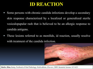 ID REACTION
 Some persons with chronic candida infections develop a secondary
skin response characterized by a localized or generalized sterile
vesiculopapular rash that is believed to be an allergic response to
candida antigens.
 These lesions referred to as monilids, id reaction, usually resolve
with treatment of the candida infection.
Shafer, Hine, Levy, Textbook of Oral Pathology, Sixth edition, Elsevier; 2009. Keratotic lesions. 613-623.
 