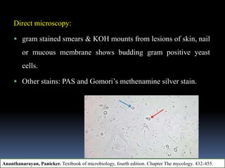 Direct microscopy:
 gram stained smears & KOH mounts from lesions of skin, nail
or mucous membrane shows budding gram positive yeast
cells.
 Other stains: PAS and Gomori’s methenamine silver stain.
Ananthanarayan, Panicker. Textbook of microbiology, fourth edition. Chapter The mycology. 432-455.
 