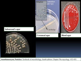 Sabouraud’s agar
Cornmeal agar Blood agar
Ananthanarayan, Panicker. Textbook of microbiology, fourth edition. Chapter The mycology. 432-455.
 