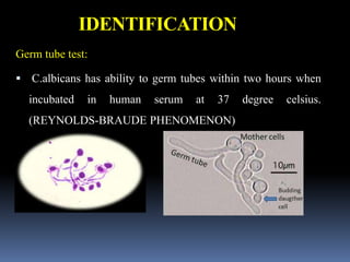 IDENTIFICATION
Germ tube test:
 C.albicans has ability to germ tubes within two hours when
incubated in human serum at 37 degree celsius.
(REYNOLDS-BRAUDE PHENOMENON)
 
