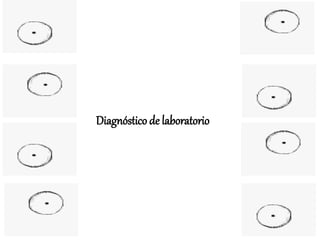 Diagnóstico de laboratorio
 