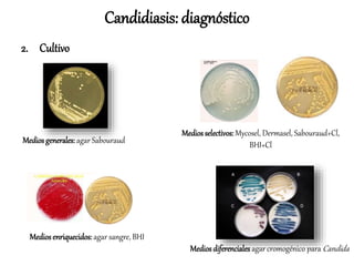 2. Cultivo
Candidiasis: diagnóstico
Mediosgenerales: agar Sabouraud
Mediosenriquecidos: agar sangre, BHI
Mediosselectivos:Mycosel, Dermasel, Sabouraud+Cl,
BHI+Cl
Mediosdiferenciales agar cromogénico para Candida
 