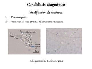 Candidiasis: diagnóstico
Identificación de levaduras
I. Pruebas rápidas:
a) Producción de tubo germinal o filamentización en suero
Tubo germinal de C. albicans 400X
 
