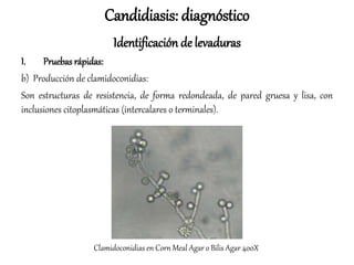 Candidiasis: diagnóstico
Identificación de levaduras
I. Pruebas rápidas:
b) Producción de clamidoconidias:
Son estructuras de resistencia, de forma redondeada, de pared gruesa y lisa, con
inclusiones citoplasmáticas (intercalares o terminales).
Clamidoconidias en Corn Meal Agar o Bilis Agar 400X
 