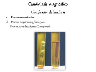 Candidiasis: diagnóstico
Identificación de levaduras
2. Pruebasconvencionales:
b) Pruebas bioquímicas y fisiológicas:
Fermentación de azúcares (Ximograma):
 