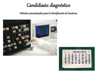 Candidiasis: diagnóstico
Métodos automatizados para la Identificaciónde levaduras
 