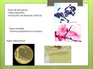 Fase de levadura
 -Fase saprofita
 -Iniciación de lesiones clínicas




  Fase micelial
  -Forma parasitaria e invasora



Agar sabouraud
 