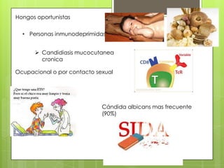 Hongos oportunistas


  • Personas inmunodeprimidas


       Candidiasis mucocutanea
        cronica

Ocupacional o por contacto sexual




                             Cándida albicans mas frecuente
                             (90%)
 