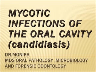 MYCOTICMYCOTIC
INFECTIONS OFINFECTIONS OF
THE ORAL CAVITYTHE ORAL CAVITY
(candidiasis)(candidiasis)
 