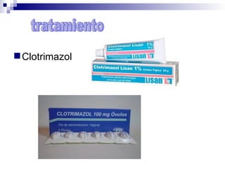  Clotrimazol