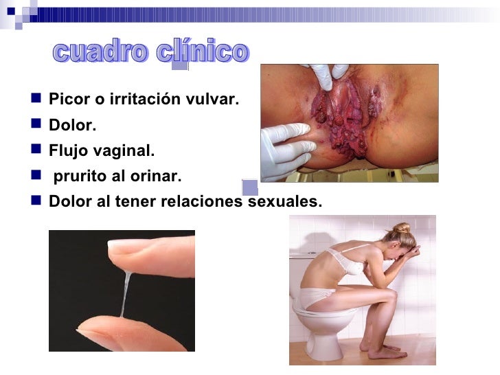 El medio más eficaz del tratamiento de los hongos de las uñas