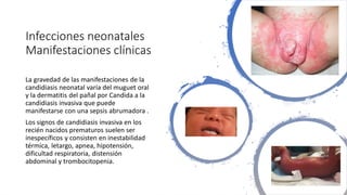 Infecciones neonatales
Manifestaciones clínicas
La gravedad de las manifestaciones de la
candidiasis neonatal varía del muguet oral
y la dermatitis del pañal por Candida a la
candidiasis invasiva que puede
manifestarse con una sepsis abrumadora .
Los signos de candidiasis invasiva en los
recién nacidos prematuros suelen ser
inespecíficos y consisten en inestabilidad
térmica, letargo, apnea, hipotensión,
dificultad respiratoria, distensión
abdominal y trombocitopenia.
 