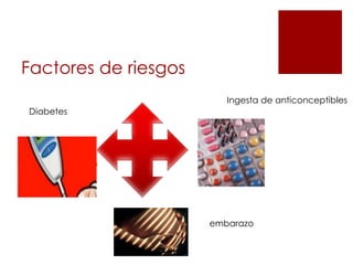Factores de riesgos
Diabetes
Ingesta de anticonceptibles
embarazo
 