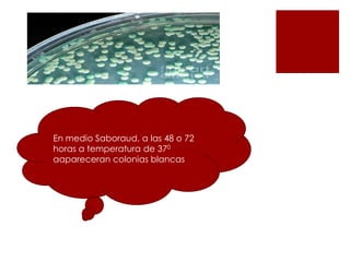En medio Saboraud, a las 48 o 72
horas a temperatura de 370
aapareceran colonias blancas
 