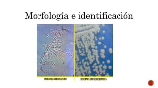 Morfología e identificación
 
