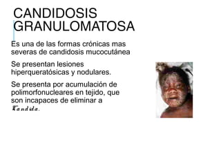 CANDIDOSIS
GRANULOMATOSA
Es una de las formas crónicas mas
severas de candidosis mucocutánea
Se presentan lesiones
hiperqueratósicas y nodulares.
Se presenta por acumulación de
polimorfonucleares en tejido, que
son incapaces de eliminar a
Candida.
 