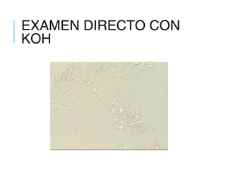 EXAMEN DIRECTO CON
KOH
 