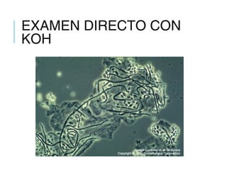 EXAMEN DIRECTO CON
KOH
 