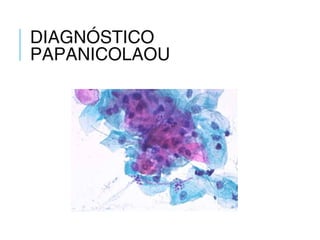 DIAGNÓSTICO
PAPANICOLAOU
 