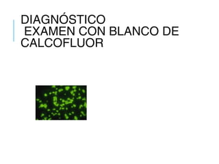 DIAGNÓSTICO
EXAMEN CON BLANCO DE
CALCOFLUOR
 