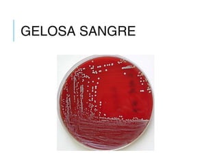 GELOSA SANGRE
 