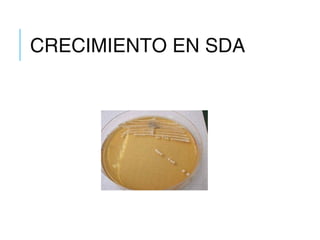 CRECIMIENTO EN SDA
 