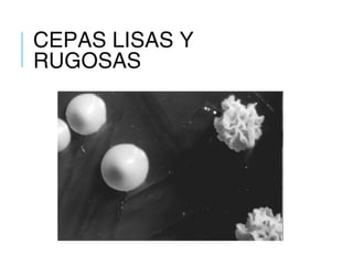 CEPAS LISAS Y
RUGOSAS
 