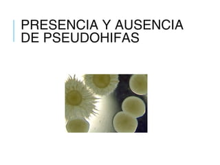 PRESENCIA Y AUSENCIA
DE PSEUDOHIFAS
 
