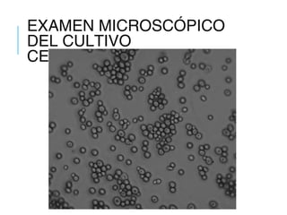 EXAMEN MICROSCÓPICO
DEL CULTIVO
CEPAS NO FILAMENTOSAS
 