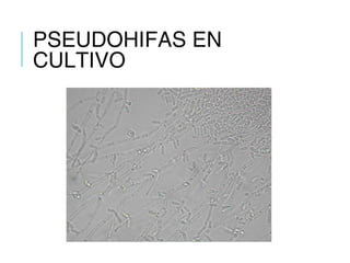 PSEUDOHIFAS EN
CULTIVO
 