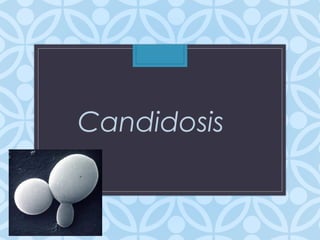 Candidosis
 