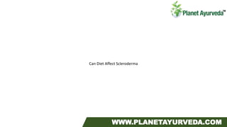 Can Diet Affect Scleroderma
WWW.PLANETAYURVEDA.COM
 