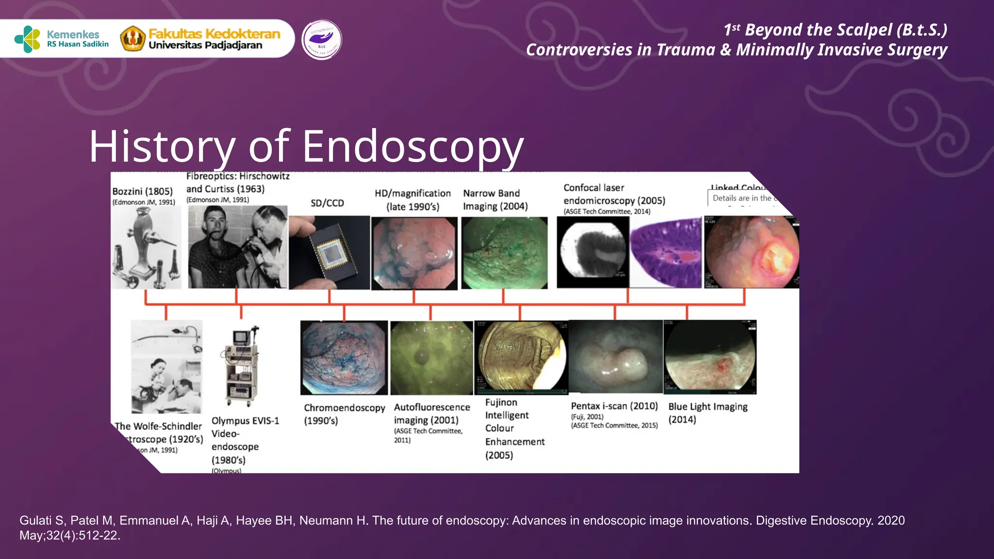 History of Endoscopy
1st
Beyond the Scalpel (B.t.S.)
Controversies in Trauma & Minimally Invasive Surgery
Gulati S, Patel M, Emmanuel A, Haji A, Hayee BH, Neumann H. The future of endoscopy: Advances in endoscopic image innovations. Digestive Endoscopy. 2020
May;32(4):512-22.
 