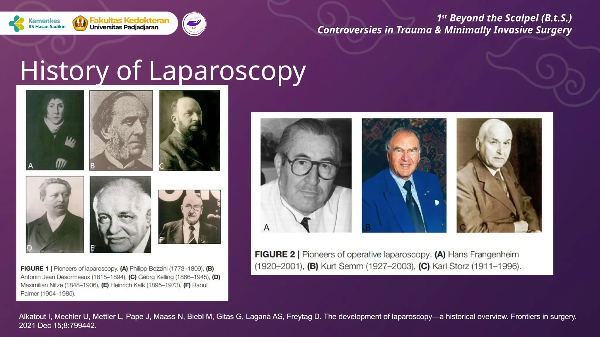 History of Laparoscopy
1st
Beyond the Scalpel (B.t.S.)
Controversies in Trauma & Minimally Invasive Surgery
Alkatout I, Mechler U, Mettler L, Pape J, Maass N, Biebl M, Gitas G, Laganà AS, Freytag D. The development of laparoscopy—a historical overview. Frontiers in surgery.
2021 Dec 15;8:799442.
Alkatout I, Mechler U, Mettler L, Pape J, Maass N, Biebl M, Gitas G, Laganà AS, Freytag D. The development of laparoscopy—a historical overview. Frontiers in surgery.
2021 Dec 15;8:799442.
 