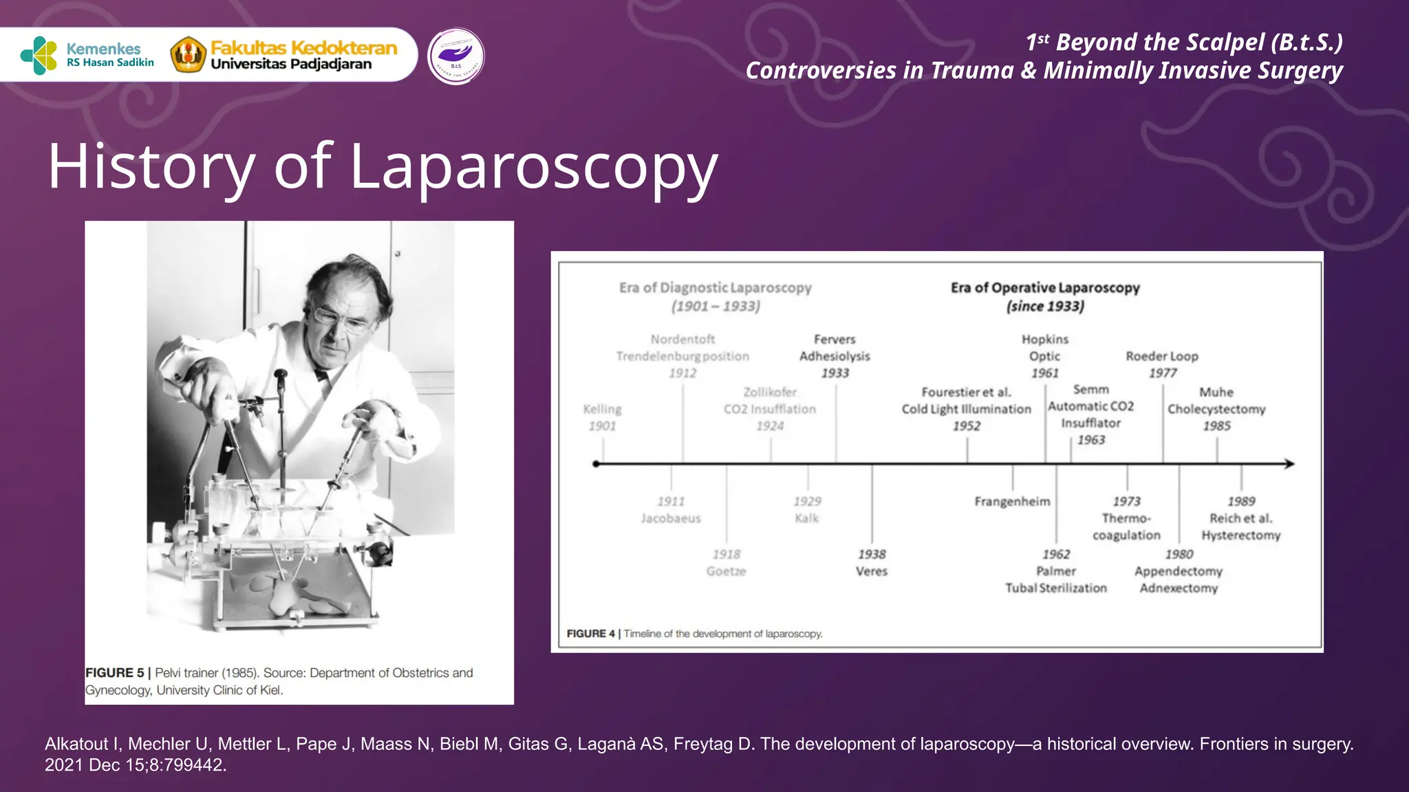 History of Laparoscopy
1st
Beyond the Scalpel (B.t.S.)
Controversies in Trauma & Minimally Invasive Surgery
Alkatout I, Mechler U, Mettler L, Pape J, Maass N, Biebl M, Gitas G, Laganà AS, Freytag D. The development of laparoscopy—a historical overview. Frontiers in surgery.
2021 Dec 15;8:799442.
 