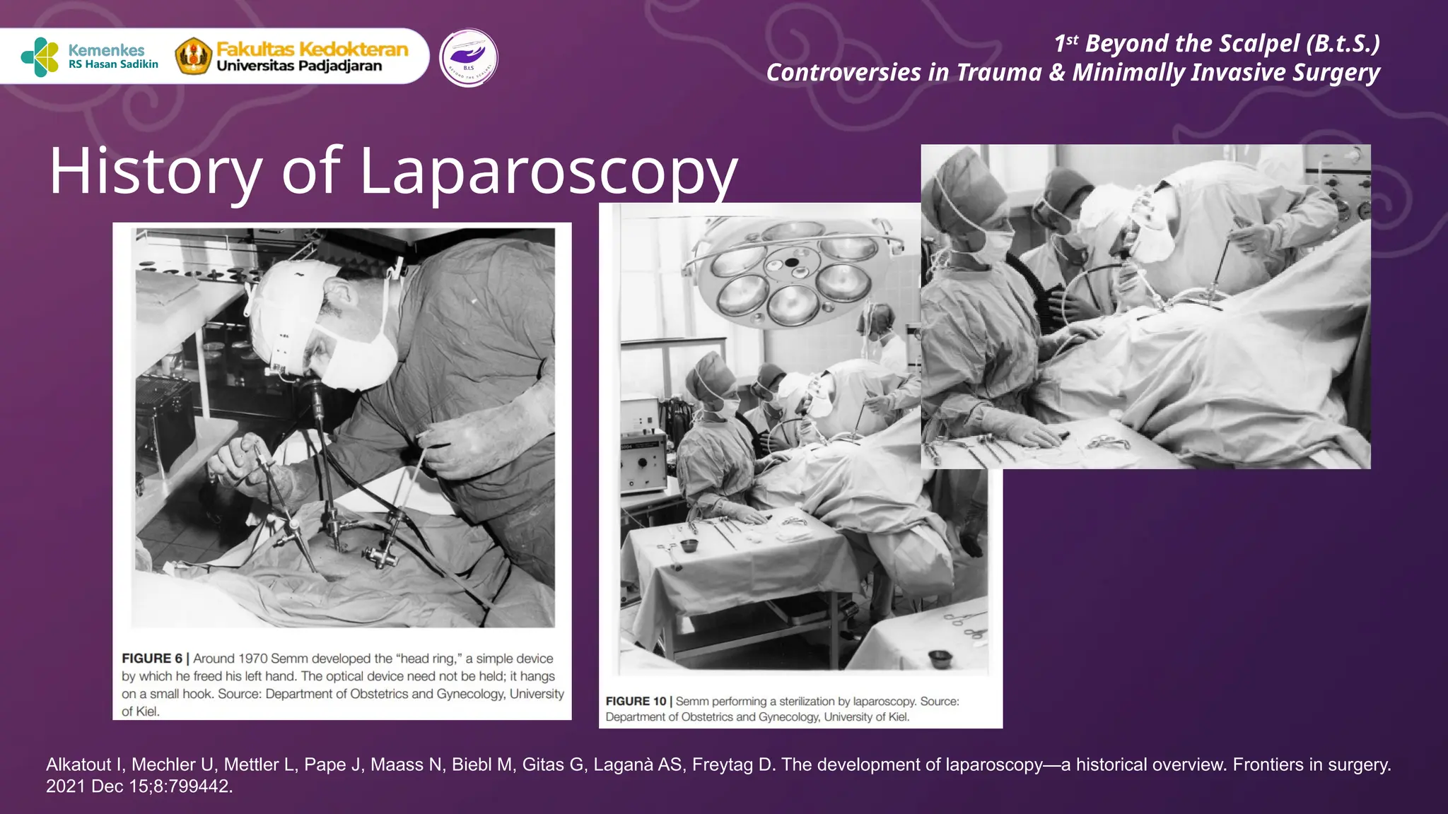 History of Laparoscopy
1st
Beyond the Scalpel (B.t.S.)
Controversies in Trauma & Minimally Invasive Surgery
Alkatout I, Mechler U, Mettler L, Pape J, Maass N, Biebl M, Gitas G, Laganà AS, Freytag D. The development of laparoscopy—a historical overview. Frontiers in surgery.
2021 Dec 15;8:799442.
 
