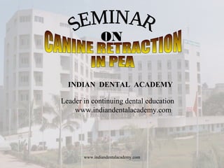 ON
www.indiandentalacademy.com
INDIAN DENTAL ACADEMY
Leader in continuing dental education
www.indiandentalacademy.com
 