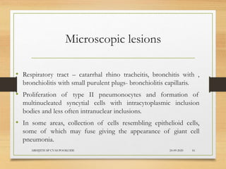 Microscopic lesions
• Respiratory tract – catarrhal rhino tracheitis, bronchitis with ,
bronchiolitis with small purulent plugs- bronchiolitis capillaris.
• Proliferation of type II pneumonocytes and formation of
multinucleated syncytial cells with intracytoplasmic inclusion
bodies and less often intranuclear inclusions.
• In some areas, collection of cells resembling epithelioid cells,
some of which may fuse giving the appearance of giant cell
pneumonia.
24-09-2020ABHIJITH SP CVAS POOKODE 16
 